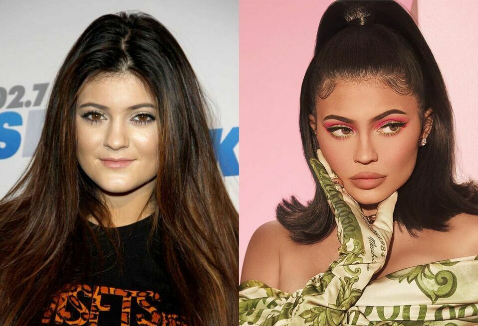 Kylie Jenner es una de las celebridades que más ha cambiado.