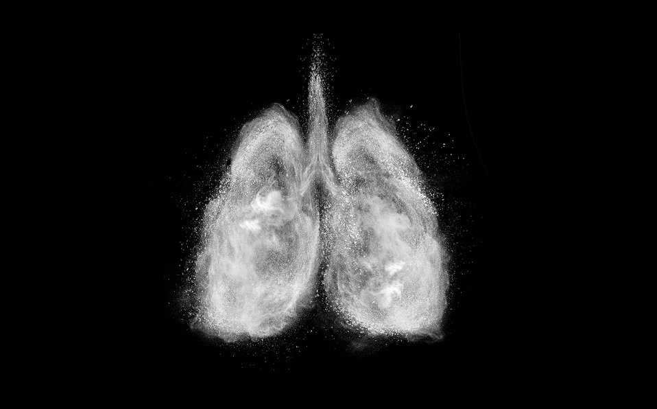 Fibrosis Pulmonar: Qué es y cuáles son sus síntomas (Foto: Getty Images)