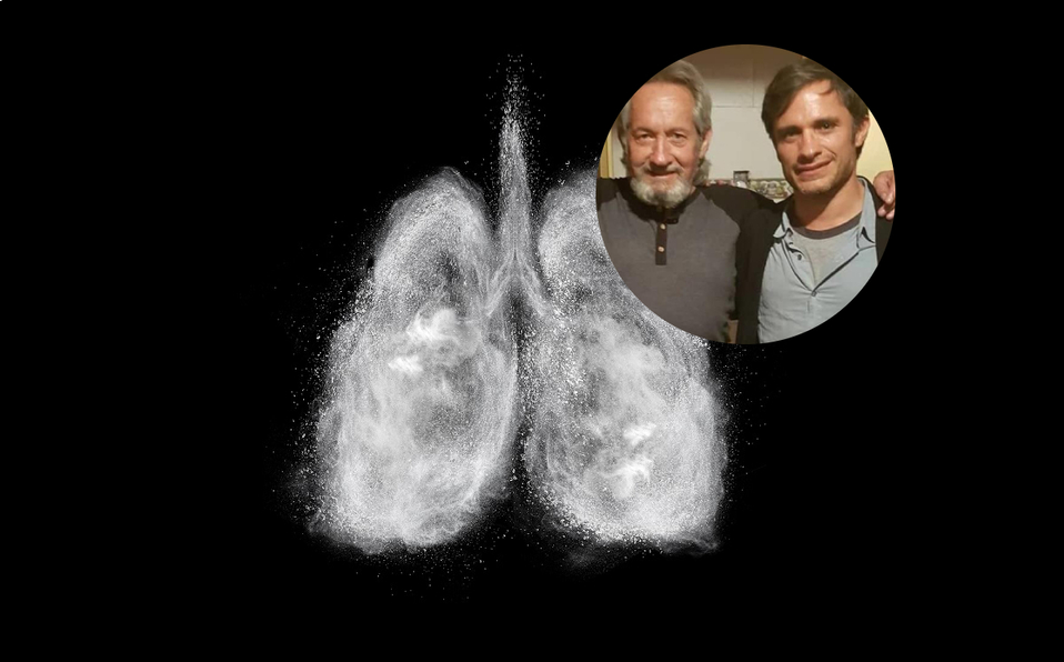 Fibrosis Pulmonar: 5 síntomas que JAMÁS debes ignorar