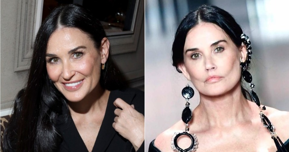 Demi Moore y sus mejillas hundidas: ¿Problema médico o cirugía? (Foto: Getty Images/Instagram)