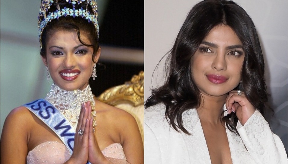 Priyanka Chopra habla sobres el antes y después de su nariz (Foto: Instagram)