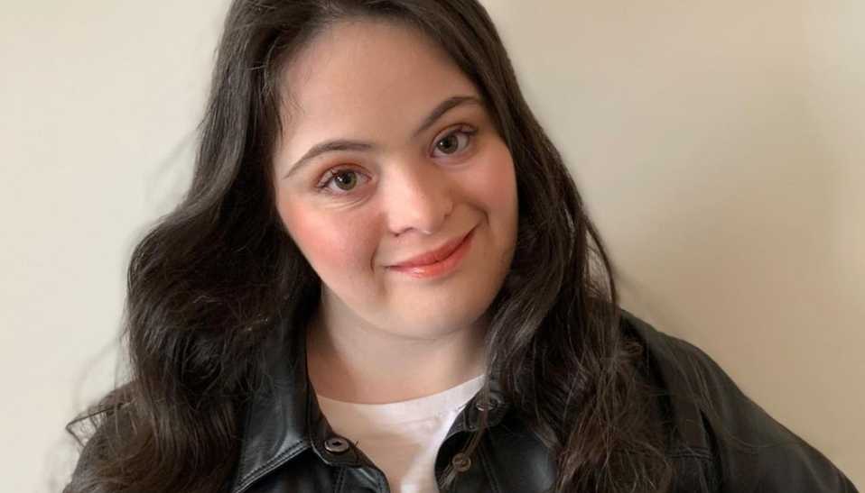 Conoce a Ellie Goldstein, la modelo Gucci con síndrome de Down (Foto: Instagram)