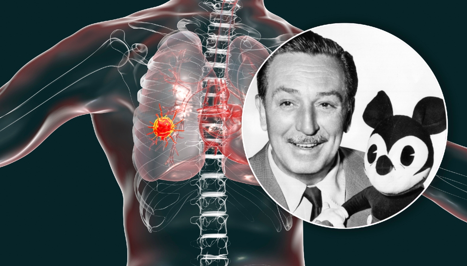 Famosos que murieron a causa de cáncer de pulmón (Foto: Getty Images)