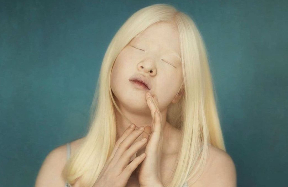 Xueli Abbing, la niña albina china que se convirtió en modelo de Vogue. (Foto: Instagram).