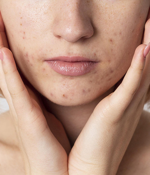 5 consejos infalibles para eliminar las manchas de la piel