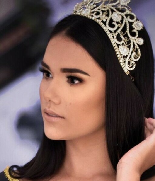 Reina de belleza de Brasil fallece en el quirófano por un tumor. (Foto: Instagram).