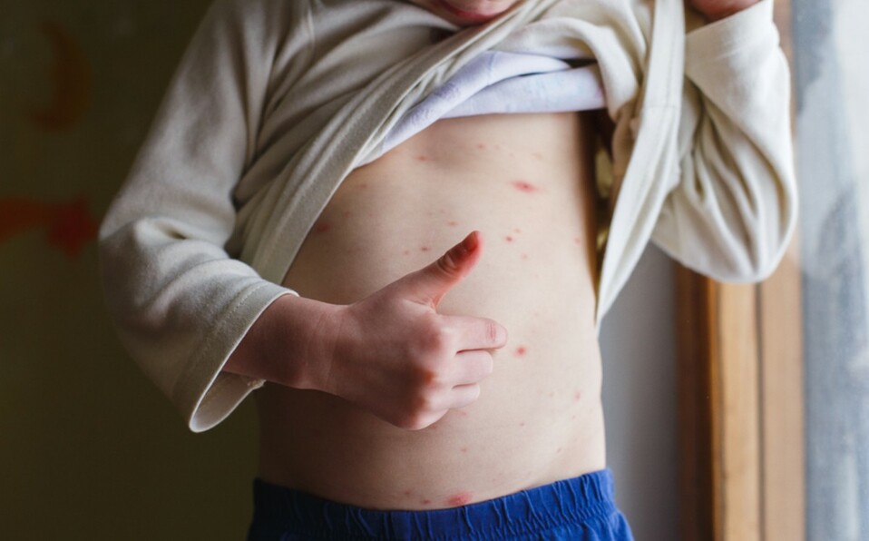 La sepsis se presenta por infecciones como urinarias y de vías aéreas, según la SSA (Foto: Shutterstock).