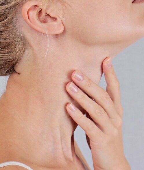 Hinchazón en el cuello es uno de los principales síntomas de la enfermedad (Foto: Shutterstock).