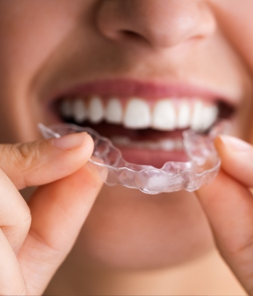 Bruxismo: Qué es y cómo evitar apretar los dientes (Foto: Getty Images)