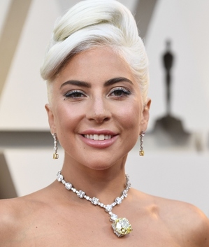 Lady Gaga y el accidente que la llevó al quirófano; ¿qué pasó? (Foto: Getty Images)