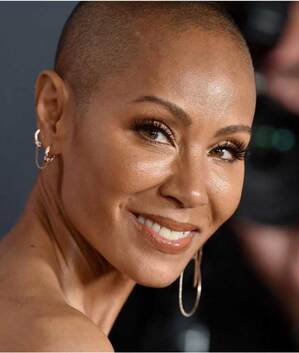 Jada Pinkett Smith lucha por aceptar la alopecia.