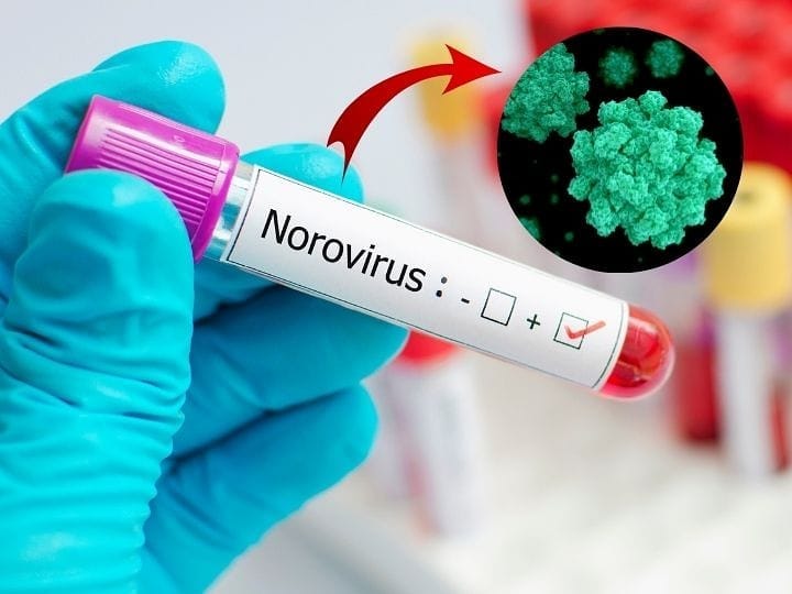 norovirus