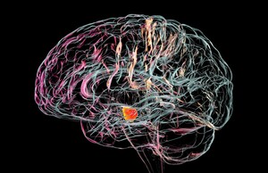 Parkinson: Síntomas, causas y tratamiento. (Foto: Getty Images).
