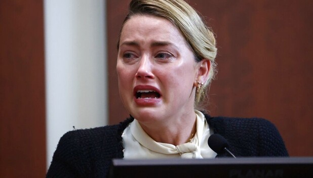 Amber Heard comparte fotos de moretones como prueba del abuso de Johnny Depp. (Foto: Instagram).