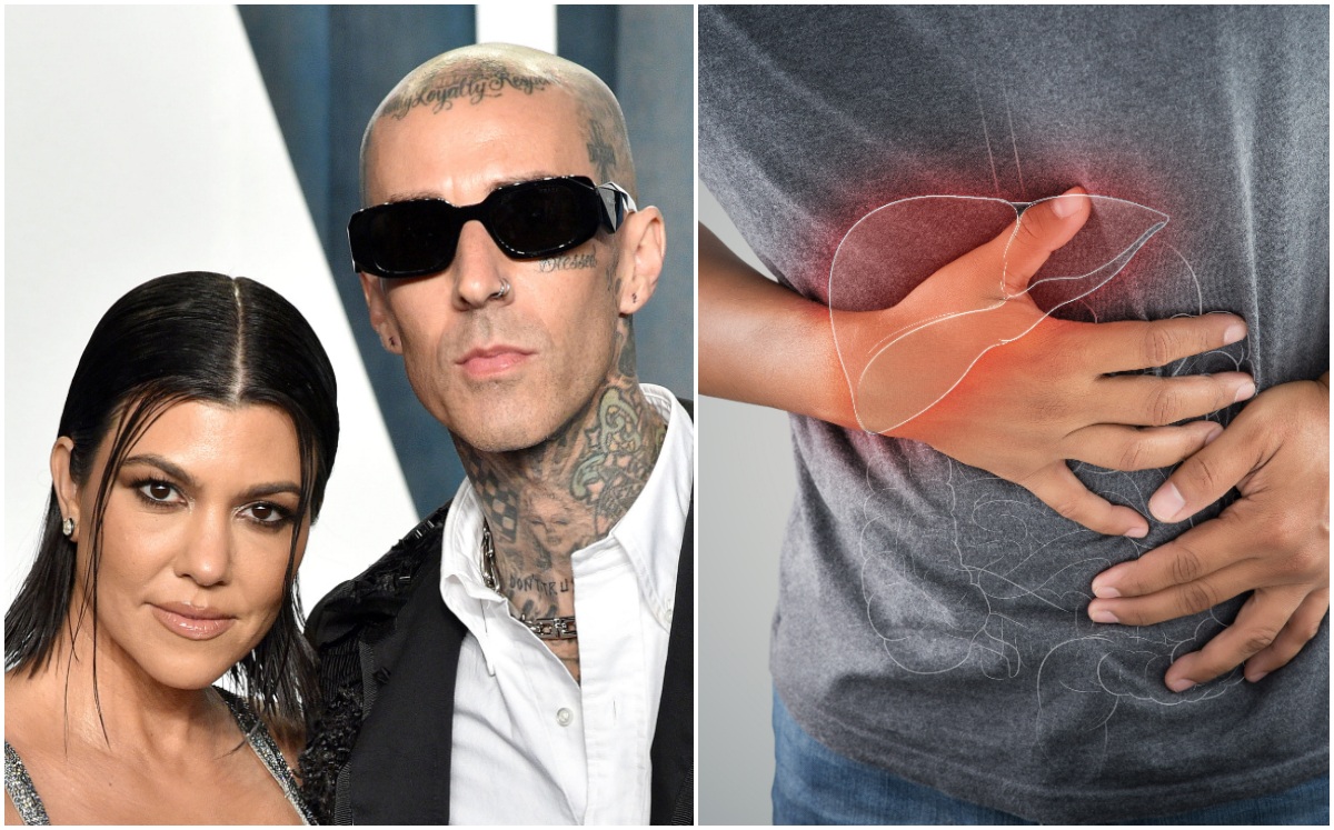 Pancreatitis: 5 señales de alarma de la enfermedad de Travis Barker (Foto: Getty Images)