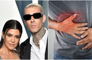 Pancreatitis: 5 señales de alarma de la enfermedad de Travis Barker (Foto: Getty Images)