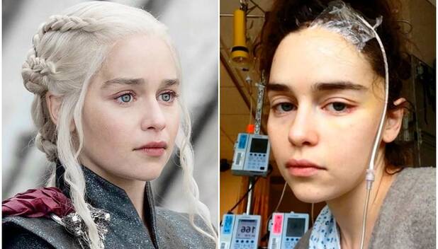 Emilia Clarke perdió parte de su cerebro tras sobrevivir 2 aneurismas (Foto: Instagram)