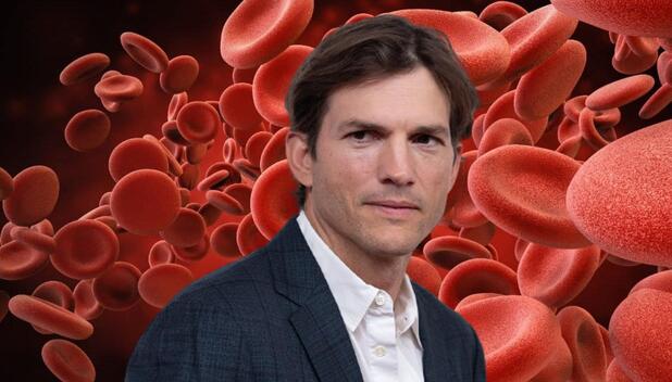 Vasculitis: Qué es la enfermedad autoinmune de Ashton Kutcher (Foto: Instagram)
