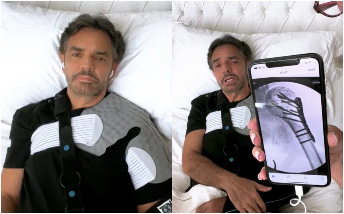 Eugenio Derbez: Muestran cómo va su recuperación | VIDEO (Foto: Instagram)