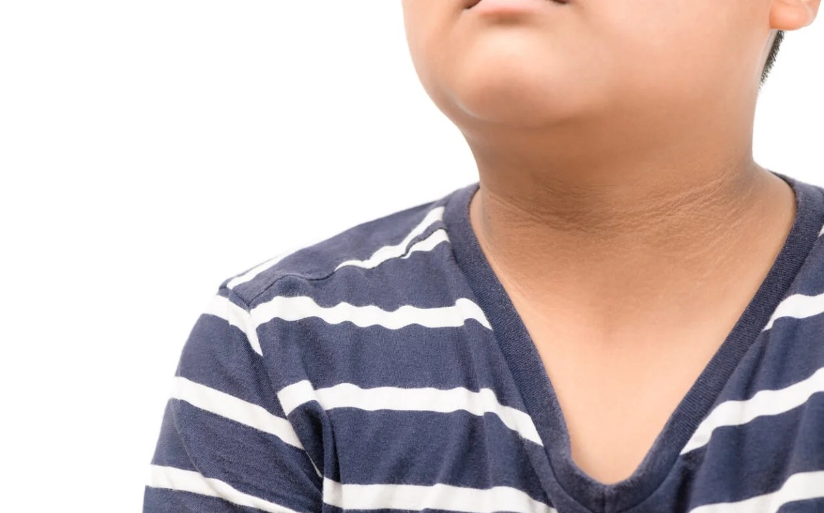 Acantosis pigmentaria: Qué es y cómo identificar este signo de diabetes (Foto: Instagram)