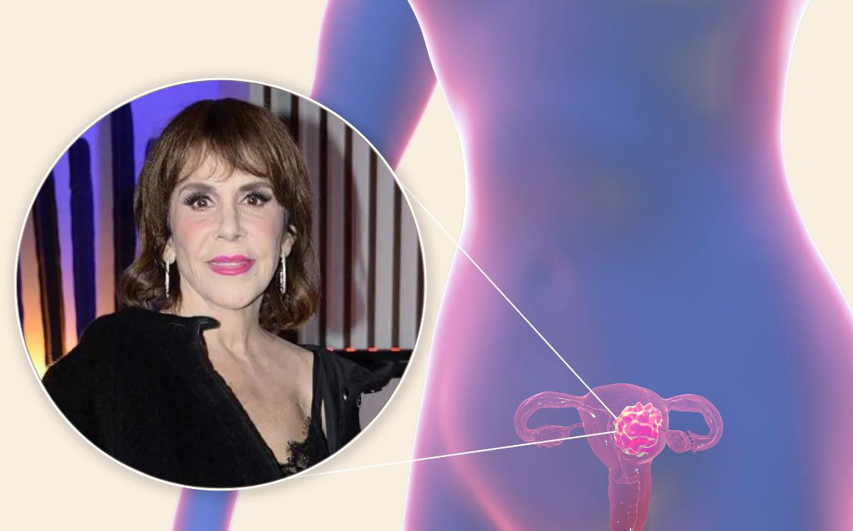 Síntomas de cáncer de ovario que ninguna mujer debe IGNORAR (Foto: Getty/Instagram)