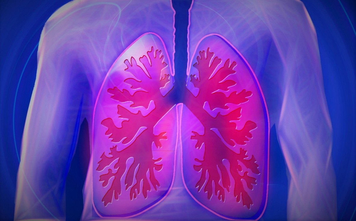 ¿Cómo empieza el cáncer de pulmón? Estos son los primeros síntomas (Foto: Pexels)