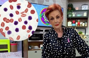 Síntomas de leucemia que sería un ERROR ignorar (Foto: Instatagram/Getty)