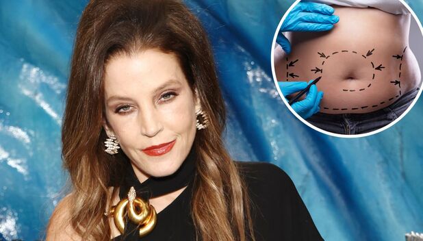 La desgarradora causa de muerte de Lisa Marie Presley (Foto: Getty)