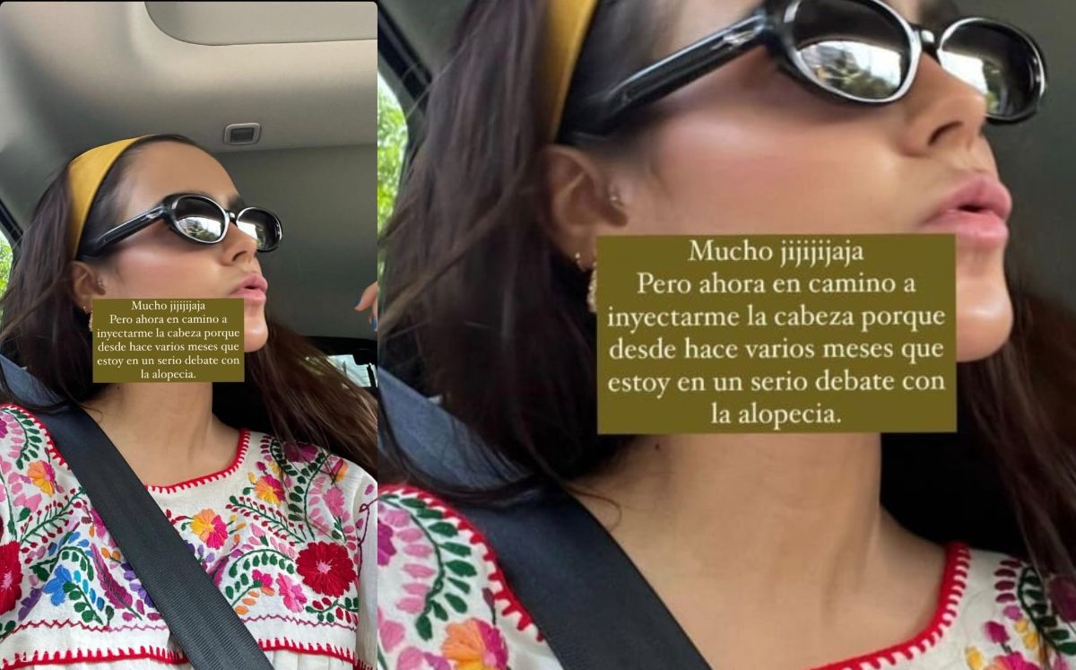 Yuya comparte una historia donde habla de su alopecia (Instagram)
