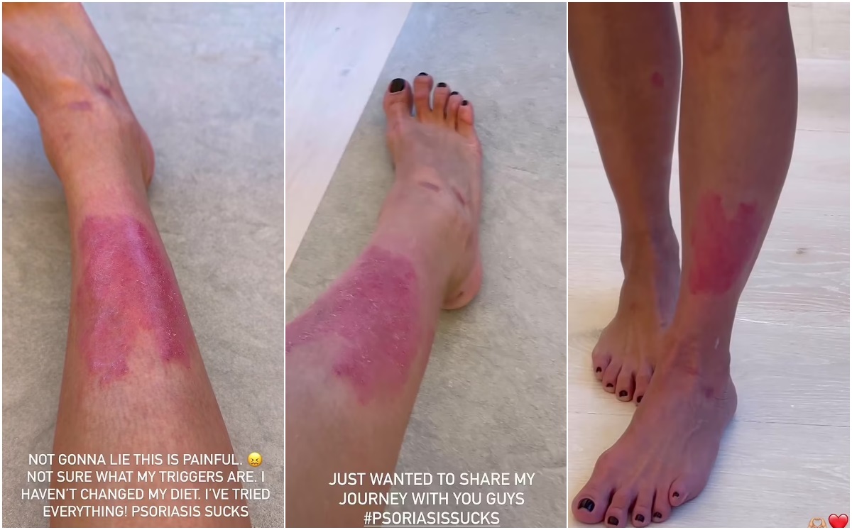 Kim Kardashian defiende las camas de bronceado por condición de su piel (Foto. Instagram)