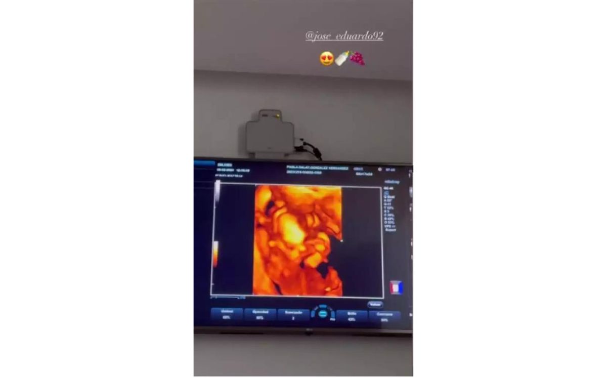 José Eduardo Derbez y Paola Dalay conocen a su bebé por ultrasonido (Instagram)