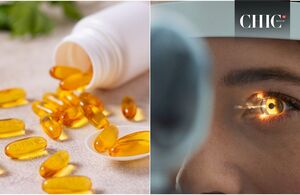Vitamina que ayuda a prevenir las cataratas y el glaucoma (Foto: Getty)