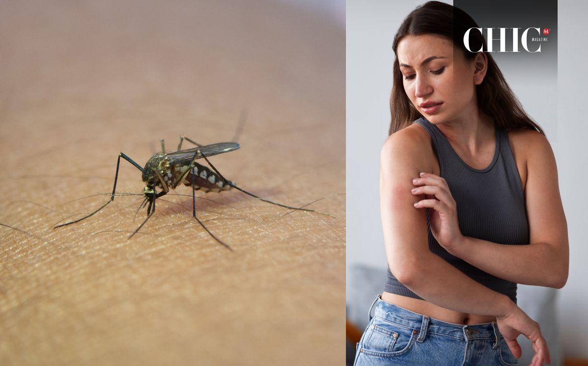 Zika: ¿Cuáles son sus síntomas y por qué es tan peligroso? (Freepik)