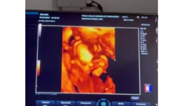 José Eduardo Derbez y Paola Dalay conocen a su bebé por ultrasonido (Instagram)