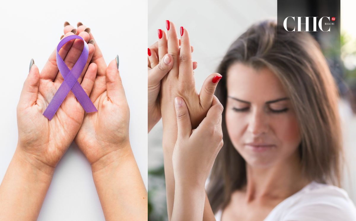 Lupus: ¿Por qué las mujeres lo padecen más que los hombres? (Freepik)