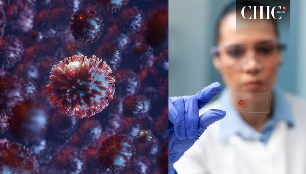 Virus de Marburgo y todo lo que debes saber (Freepik)