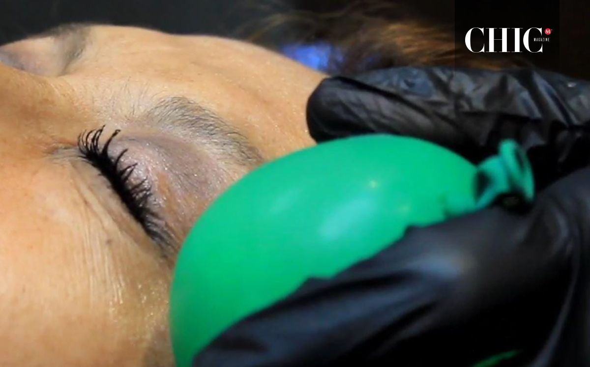 Colocación de hielo tras la aplicación de bótox en el rostro (Foto: Leslie Anisahi)