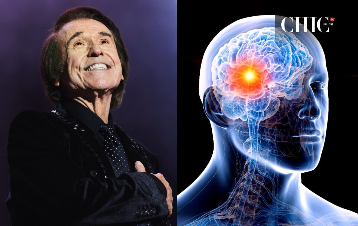 Linfoma cerebral primario: Qué es y síntomas de la condición de Raphael (Foto: Getty)