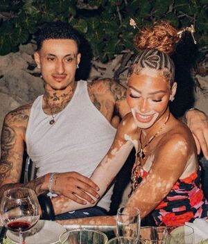 Winnie Harlow y Kyle Kuzma se comprometen (Jamie Bruce)