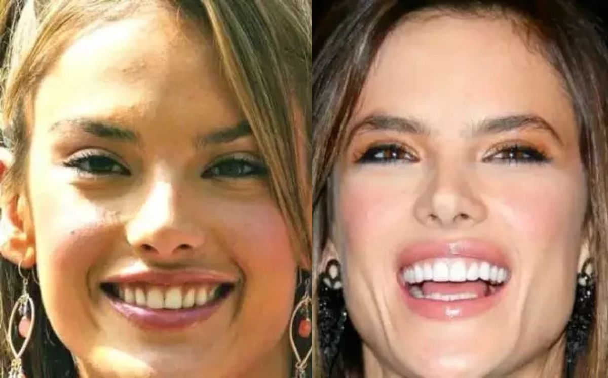 Alessandra Ambrosio: Antes y después de la fama (Instagram)