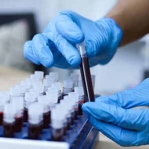 ¿Sangre de laboratorio? La creación que podría salvar la vida de miles de personas (Getty Images)