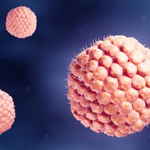 Conoce todo lo que debes saber sobre el herpes zóster (Getty Images)
