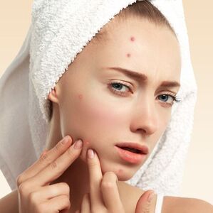 Prevención de brotes de acné: Tratamientos y tips para cuidar tu piel (Foto: Freepik)