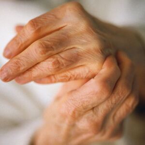 Conoce los síntomas iniciales de la artritis reumatoide, cómo reconocerlos y prevenir daños irreversibles (Getty Images)