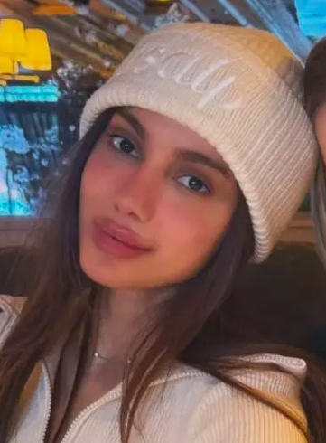 Nuevo rostro de Anitta (Instagram)