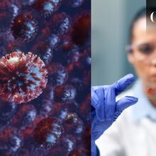 Virus de Marburgo y todo lo que debes saber (Freepik)