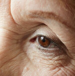 Investigaciones sugieren que las olas de calor podrían influir en el glaucoma y la salud visual (Freepik)