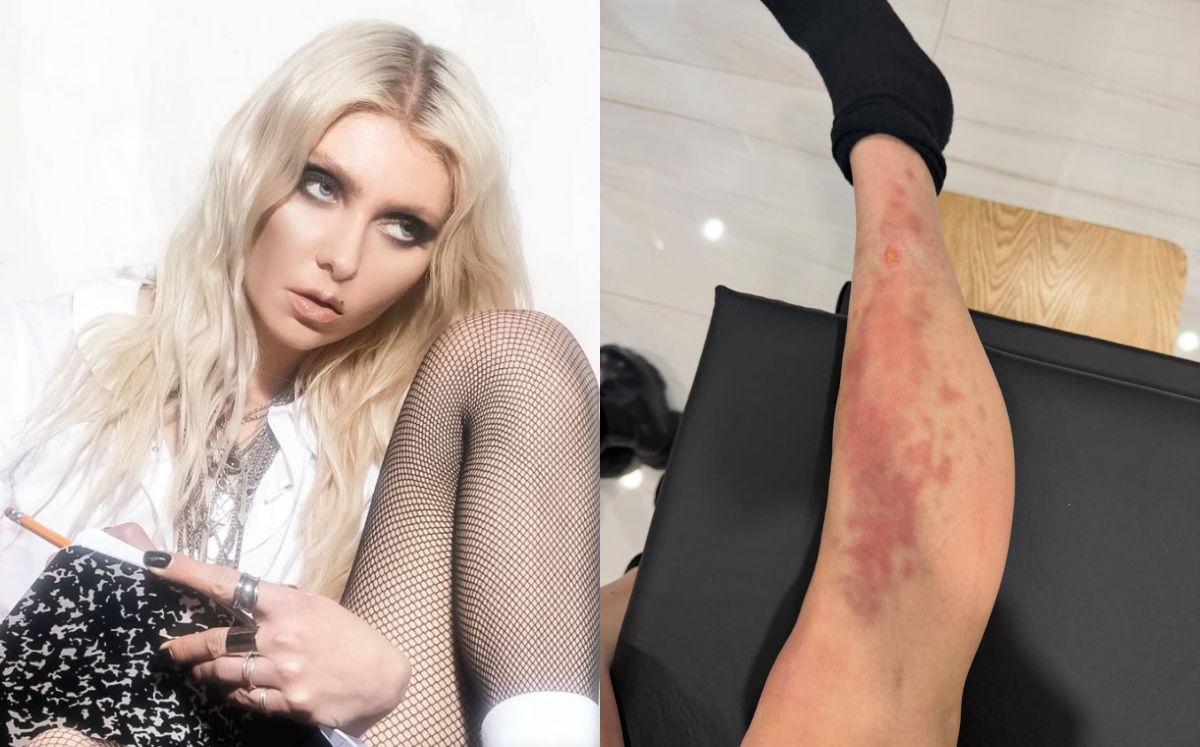 Taylor Momsen es hospitalizada por picadura de araña en México (Foto: Instagram)