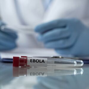 Emergencia internacional por brote de ébola; ¿cuál es el riesgo en México? (Foto: Freepik)