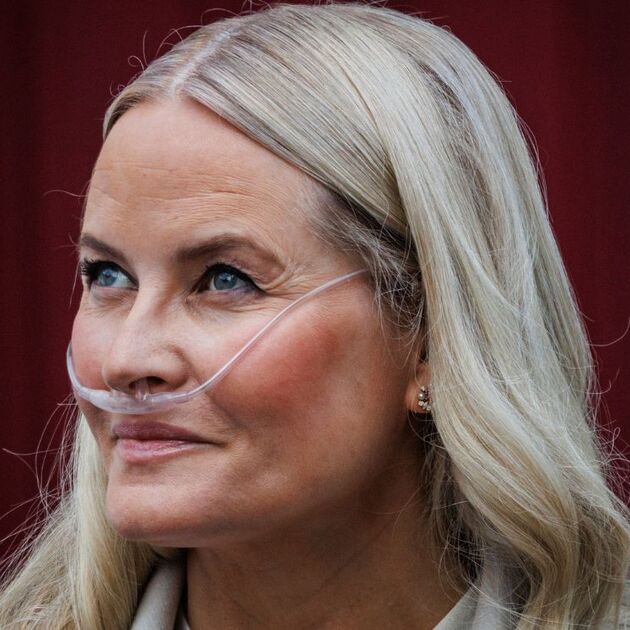 ¿Qué se sabe del posible trasplante de pulmón de la princesa Mette-Marit? (Foto: Getty Images)